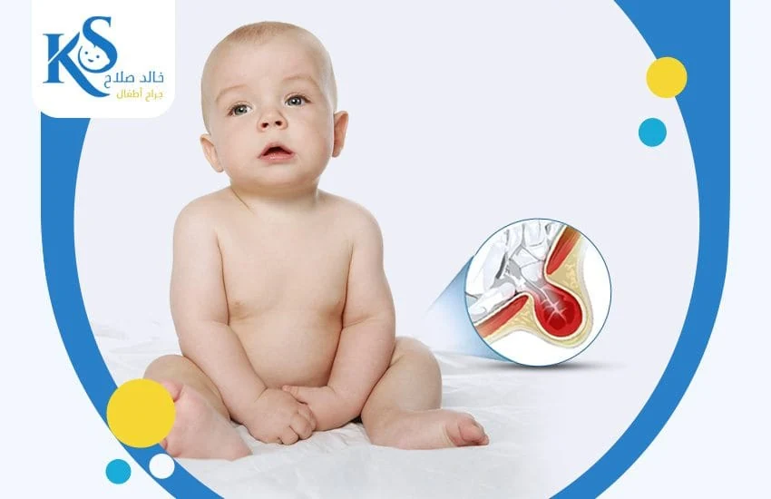 دكتور خالد صلاح – جراحة الأطفال